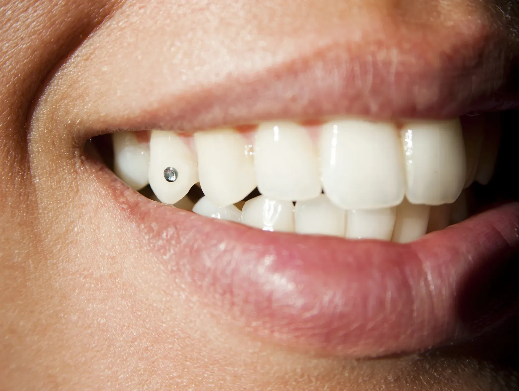 Tooth Jewellery | Krity 360 | Bangalore