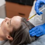 PRP Therapy for Hair Growth: Everything You Need to Know