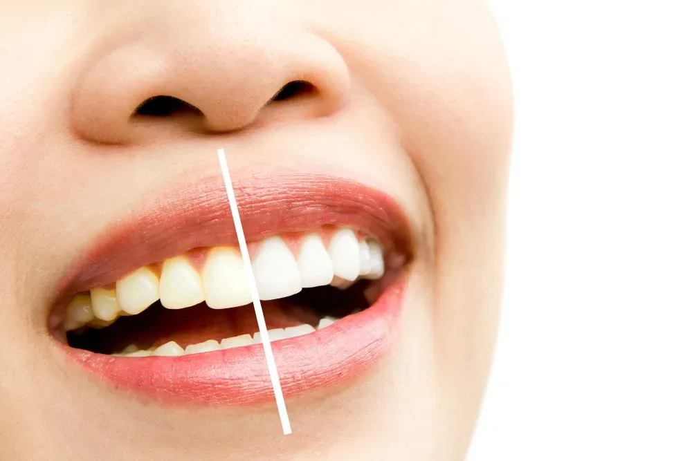 Smile Enhancement & Cosmetic Dentistry