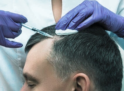 Exosomes Therapy for Skin & Hair in Bangalore