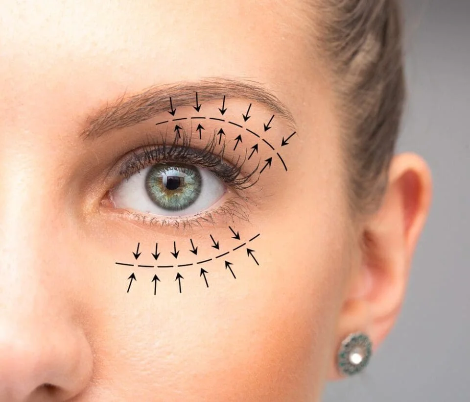 Blepharoplasty | Krity 360 | Bangalore